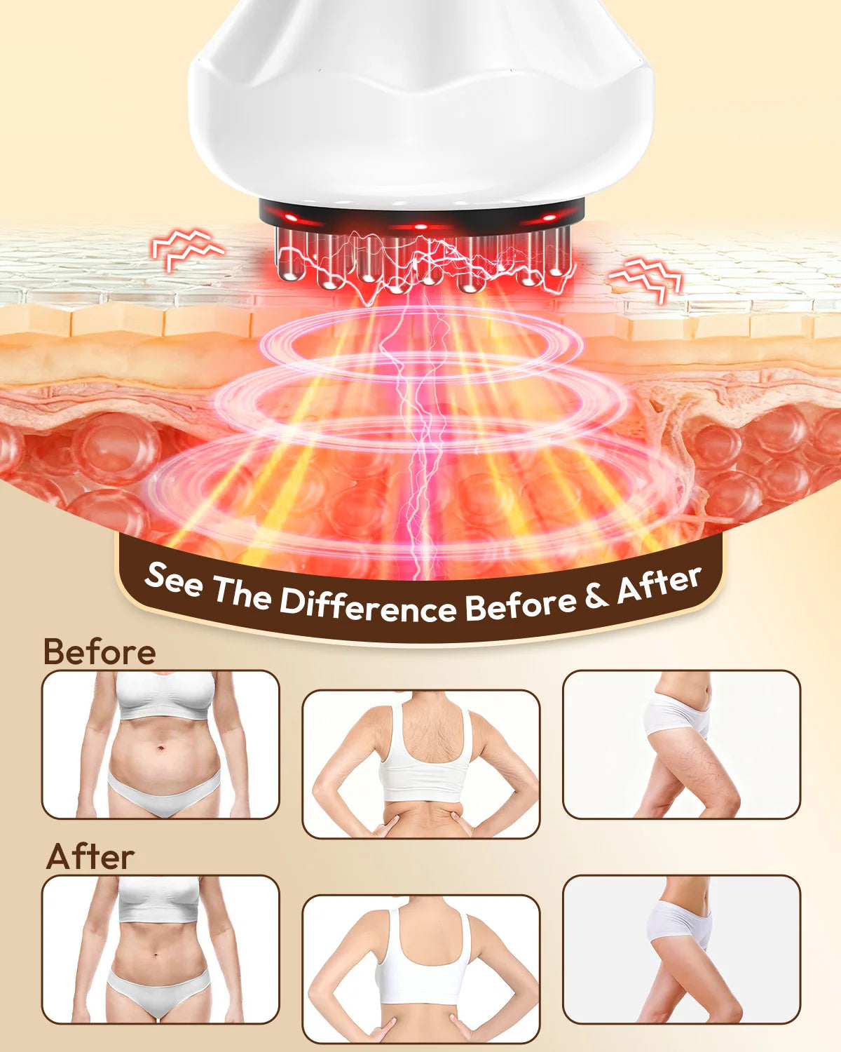 Lymphatic Drainage Massager and Cellulite Tool MR10013